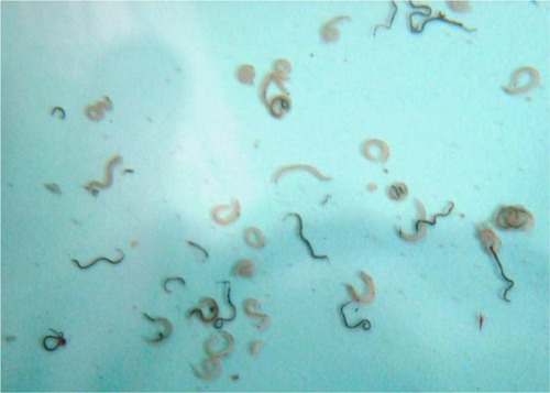 Figure 1 Male (pinkish-colored) and female (dark-colored) S. mansoni worms recovered by perfusion of mice (Actual size).