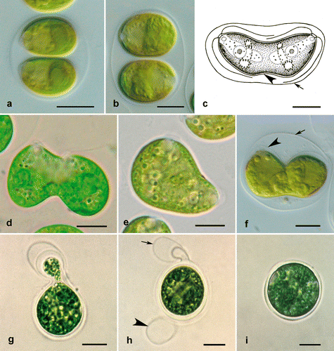 Fig. 8. Reproduction in Microglena. a, b. Asexual reproduction by zoosporulation (a without rotation of protoplast, b with rotation of protoplast by 90°). c–f. Incomplete cell division similar to asexual reproduction by protocytotomy; note the extended mother cell wall (arrows) and newly synthesized daughter cell walls (arrowheads). g–i. Sexual reproduction by advanced anisogamy: g shows fusing macro- and microgametes, h an empty microgametangium (arrow) and an empty macrogametangium (arrowhead) on the wall of the young zygote, and i a young zygote. a Microglena opisthopyren (SAG 8.87), b, d Microglena longirubra (SAG 5.92), c Microglena monadina (SAG 55.72), e Microglena lobata (SAG 31.72), f–i Microglena coccifera (SAG 55.91). Scale bars = 10 µm.