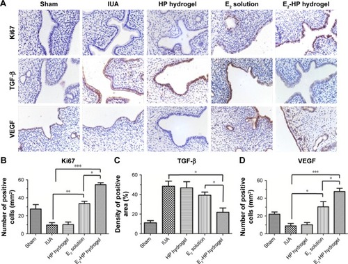 Figure 8 Immunohistochemical staining of Ki67, TGF-β, and VEGF.Notes: (A) The expression of Ki67, TGF-β, and VEGF in the immunohistochemical staining of endometrium (400×) on the 14th day after IUA with different treatments. (B) Analysis of Ki67 positive cells of the immunohistochemistry results. (C) Analysis of TGF-β positive area of the immunohistochemistry results. (D) Analysis of VEGF-positive cells of the immunohistochemistry results. Data are presented as mean ± standard deviation; n=5; *P<0.05, **P<0.01, and ***P<0.001.Abbreviations: IUA, Intrauterine adhesions; HP, heparin-poloxamer.