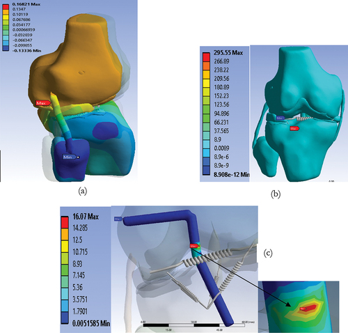 Figure 7. AMP technique: (a) Displacement in the knee joint, (b) Stress in the knee joint, (c) Stress in the R—ACL.