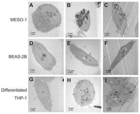 Figure 2 TEM image of cells exposed to VGCF. Cells were exposed to varying concentrations of VGCF for 24 hours. (A, D and G) DM only. (B and H) 10 μg/mL SB. (C and I) 10 μg/mL VGCF. (E) 1 μg/mL SB. (F) 1 μg/mL VGCF.Abbreviations: TEM, transmission electron microscope; VGCF, vapor-grown carbon fiber; SB, Sumi black; DM, dispersion medium.