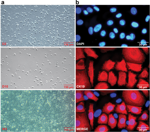 Figure 2.  (a) JEC cultures generated from periodontitis tissues by tri-enzymatic digestion. Micrographs on day 2 (D2), day 10 (D10), and week 3 (W3) are presented. Magnification, 100×. After 3 weeks of culture, cells grew to over 90% confluency and exhibited epithelial-like morphology. (b) Immunofluorescent staining of CK19 (junctional epithelial cell marker; red fluorescence) in JEC monolayers at passage 2 (P2). Cell nuclei are stained with DAPI. Magnification, 1000×. Most of the cells in the P2 subculture were JECs.
