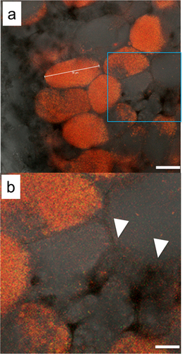Figure 2. Overlay of DsRed, eGFP, and bright-field images of a root nodule formed by the inoculation of almost equal numbers of DsRed-labeled USDA122 and eGFP-labeled USDA122, in the absence of SSBR45. Panel (b) is a zoomed-in image of the square zone indicated in (a). In this nodule, infected cells were occupied only by DsRed-labeled USDA122. Arrowheads indicate intercellular spaces where USDA122 bacteria were observed. Scale bars: (a), 25 µm, and (b), 10 µm.