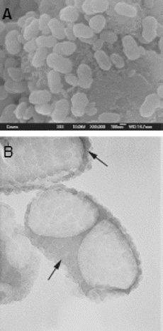 Figure 1. Images of cultured nanobacteria, taken by (A) scanning electron microscope and (B) transmission electron microscope.