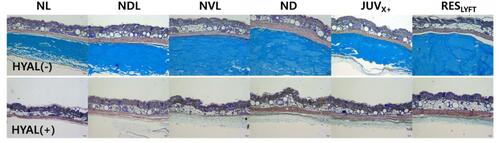 Figure 4 Cross section of sites with subcutaneously implanted HA dermal fillers (91-day filler residence time) before and two weeks after injection with 60 IU hyaluronidase (HYAL) per 0.1-mL HA filler volume. Alcian blue-stained areas show the HA filler layer before HYAL injection (top) and two weeks after treatment (bottom).