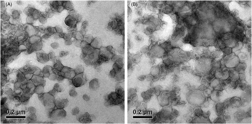 Figure 2. Transmission electron microscope photos of PTX-TSL (A) and NTSL (B), which show the morphology of the liposome dropped on a copper grid and stained with 2% phosphotungstic acid, then observed by TEM (JEM-1010, JEOL Ltd., Tokyo, Japan).
