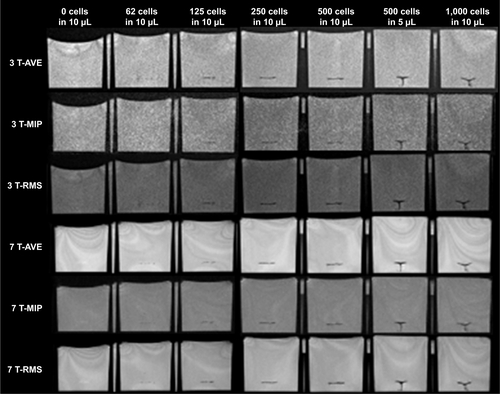 Figure S1 AVE, MIP, and RMS combined phase-cycled bSSFP images of different concentrations of cells (0, 62, 125, 250, 500, and 1,000 cells in 10 μL medium including 500 cells in 5 μL medium) in the gelatin phantom.Note: Phase-cycled bSSFP images were combined with three methods to minimize banding artifacts.Abbreviations: AVE, average of the signal; bSSFP, balanced steady-state free precession; MIP, maximum intensity projection; RMS, root mean square.