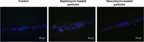 Figure 9 FISH of Staphylococcus epidermidis biofilms after 24 hours incubation with 20 mg/mL of daptomycin- and vancomycin-loaded PCL microparticles.Notes: Sessile staphylococci biofilms were hybridized with pan-bacterial EUB 338FITC and staphylococci-specific STAPHYFITC probes (green) as well as stained with DAPI (blue). Untreated biofilms were used as controls. Magnification: 400×.Abbreviations: FISH, fluorescence in situ hybridization; PCL, poly-epsilon-caprolactone; DAPI, 4′,6-diamidino-2-phenylindole.