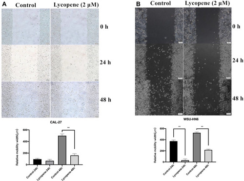 Figure 2 Lycopene suppresses the cell migration of the OSCC cell lines (CAL-27, WSU-HN6). The wound-healing assay showed that the relative migration of cells incubated with lycopene in (A) CAL-27 and (B) WSU-HN6 cell lines was significantly less than the control group.