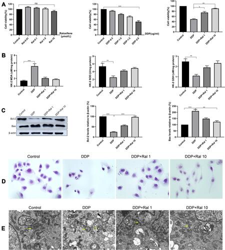 Figure 5 Raloxifene attenuated cisplatin-induced oxidative stress in HK-2 cells. (A) Effect of raloxifene on cisplatin-induced cytotoxicity in HK-2 cells. HK-2 cells were treated with indicated concentrations of raloxifene (0.01–10 μM), cisplatin (0.5–2 μg/mL), cisplatin (2 μg/mL) + raloxifene (1 μM or 10 μM) for 24 h. (B) MDA, SOD and GSH levels in HK-2 cells. HK-2 cells were treated with indicated concentrations of cisplatin (2 μg/mL), cisplatin (2 μg/mL) + raloxifene (1 μM or 10 μM) for 24 h. (C) Western blot assay for the detection of Bcl-2 and Bax expression in each group and quantifications: β-actin was used to normalize protein expression levels. (D) H&E morphological staining of HK-2 cells (original magnification: × 200). Values are the mean ± SD of three independent experiments. *P < 0.05, **P < 0.01, ***P < 0.001 vs control. (E) TEM analysis shows mitochondrial swelling and severe disruption of mitochondrial structures in DDP-treated HK-2 cells, only a few mitochondria are present and they appear swollen and have lost cristae. TEM picture of control group HK-2 cells, showing elongated mitochondria with normal cristae structure. TEM picture of DDP+Ral (1 μM or 10 μM) groups HK-2 cells, showing many normal mitochondria are still present, but disrupted mitochondria that are swollen are also observed in a few mitochondria.