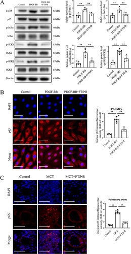 Figure 4 FTS•B blocked the activation of the NF-κB signaling pathway. PASMCs were treated with PDGF-BB in the presence or absence of FTS•B for 24 h. (A) Representative Western blotting of p-p65, p65, p-IκBα, IκBα, p-IKKα, IKKα, p-IKKβ and IKKβ, and quantitative analysis of p-p65/p65, p-IκBα/IκBα, p-IKKα/IKKα and p-IKKβ/IKKβ (n = 5). (B) Immunofluorescence staining of p65 in PASMCs (p65, red; DAPI, blue; scale bar = 50 μm) and quantitative data of nuclear p65 immunofluorescence intensity (n = 6). (C) Representative immunofluorescence staining of p65 in pulmonary artery (p65, red; DAPI, blue; scale bar = 50 μm) and quantitative data of nuclear p65 immunofluorescence intensity (n = 6). The data are presented as the mean ± SD. *p < 0.05,**p < 0.01.