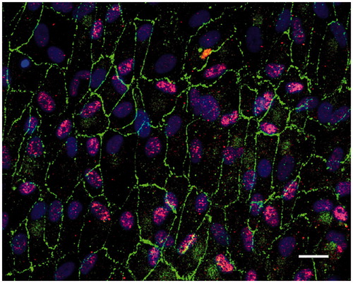 Figure 2. Immunofluorescent images of human post-confluent ARPE cells double-labeled for the tight junction protein ZO-1 (green) and RPE65 (red, specific for RPE cells) and counterstained with DAPI (blue). Scale bar, 20 μM.