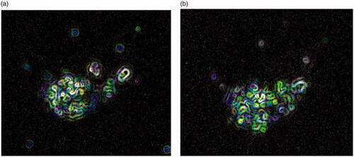 Figure 6. Representative fluorescent microscopy images of MCF-7 cells after 12 h exposure (a) and after 24 h exposure (b) to 3.0 mg/mL nanodiamond–doxorubicin conjugates. Green identifies the fluorescence due to Ethidium Bromide staining. All images are shown with 40× magnification.