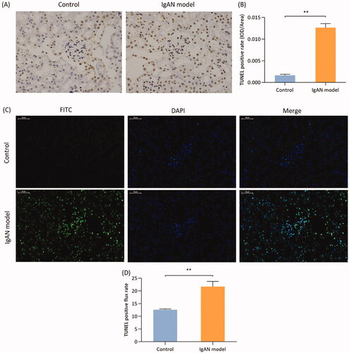 Figure 4. Podocyte apoptosis in IgAN mice. (A) TUNEL (biotin-labeled peroxidase) detection (magnification, x400) and the (B) results were quantified. (C) TUNEL method (FITC labeling) method (magnification, x400) and (D) quantification of the results. Data are expressed as mean ± SD. vs. control group. IgAN, IgA nephropathy.