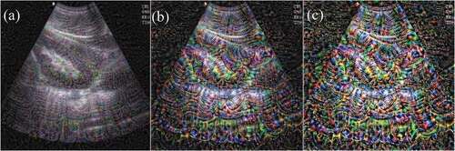 Figure 3. Computer-generated images of ultrasound kidney images using different convolutional filters. (A), (B), and (C) are the images after convolutional filters 12, 30, and 48, respectively. The deeper the number of network filter layers, the more saturated the colors and the more obvious the features.