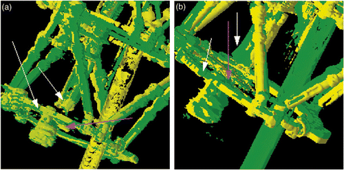 Figure 6. (a) The fused proximal volume (FVOL-3) for patient 2 was used to align the bottom frame (yellow: fused distal volume (FVOL-4); green: original CT-A volume from first scan date). Both the bottom frame and the distal tibia (white arrows) are well aligned. The bottom pins (magenta arrow) are slightly off, but not nearly as much as at the top. (b) The fused distal volume (FVOL-4) was used with bony landmarks to further align the distal tibia (FVOL-5). The distal frame, distal tibia (white arrows) and pins (magenta arrow) are all well aligned (yellow: FVOL-5; green: original CT-A volume from first scan date).