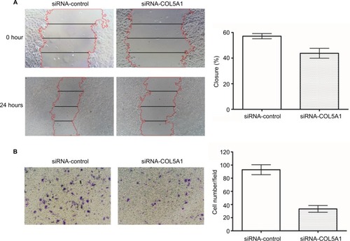 Figure 4 Effect of COL5A1 knockdown on cell migration and invasion in vitro.Notes: (A) Representative images of wound healing assay. Knockdown of COL5A1 significantly inhibited Caki-1 cells migration. (B) Representative images of crystal violet-stained migrated cells. Knockdown of COL5A1 significantly inhibited Caki-1 cells invasion.