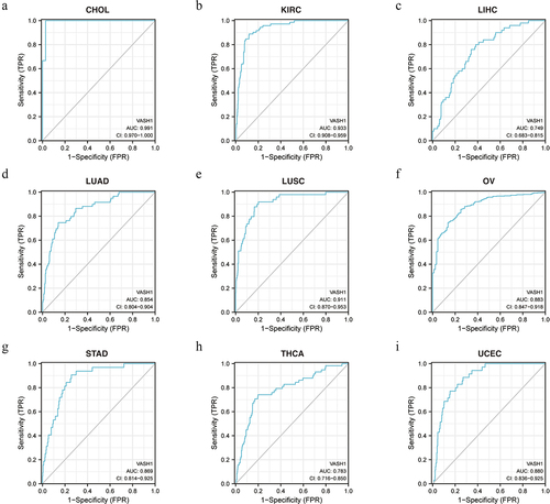 Figure 3. The function of VASH1 in clinical diagnosis. VASH1 could be used as a beneficial biomarker for clinical diagnosis in CHOL (a), KIRC (b), LIHC (c), LUAD (d), LUSC (e), OV (f), STAD (g), THCA (h) and UCEC (i). CHOL, cholangiocarcinoma; KIRC, renal clear cell carcinoma; LIHC, liver hepatocellular carcinoma; LUAD, lung adenocarcinoma; LUSC, lung squamous cell carcinoma; OV, ovarian serous cystadenocarcinoma; STAD, stomach adenocarcinoma; THCA, thyroid carcinoma; UCEC, uterine corpus endometrial carcinoma.