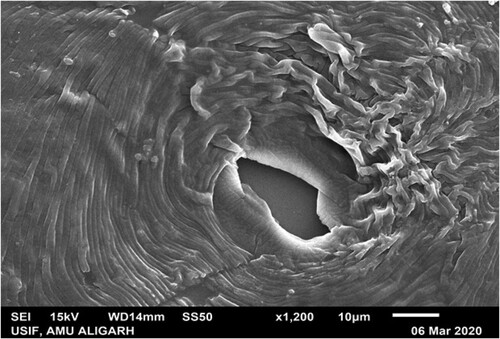 Figure 1. Scanning electron microscopy showing the perineal pattern of M. incognita. The high squared dorsal arch, wavy striae are key features of M. incognita.