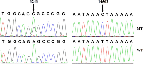 Figure 2 Identification of tRNALeu(UUR) A3243G and ND6 T14502C mutations by direct sequencing.