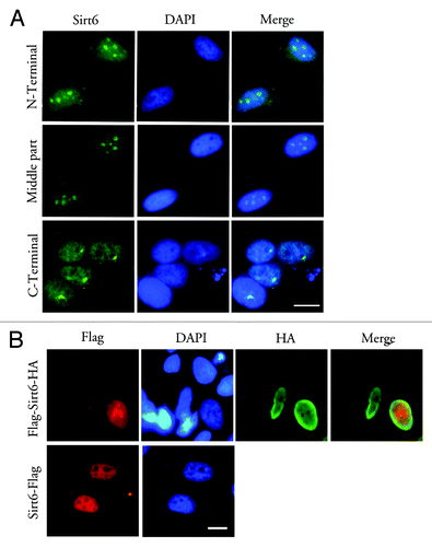 Figure 4. Antibodies against the Sirt6 C-terminus or C-terminal tags cannot detect nucleolar Sirt6. (A) In G1-arrested cells, antibodies against the Sirt6 N-terminus (Sigma) (upper row) and against a middle region of Sirt6 (middle row) show a nucleoplasmic signal and a strong nucleolar signal. Meanwhile, the antibody against the C-terminus (Sigma) does not show a nucleolar signal, but instead shows a diffuse nucleoplasmic signal and a strong signal in the perinucleolar region (lower row). (B) When Sirt6 was tagged with FLAG at its N-terminus and HA at its C-terminus, the anti-FLAG antibody shows nucleolar Sirt6, while anti-HA is not detectable in the nucleolus (upper row). Anti-FLAG also cannot detect any Sirt6 when the tag is at the C-terminus (lower row). Scale bars, 10 µm.