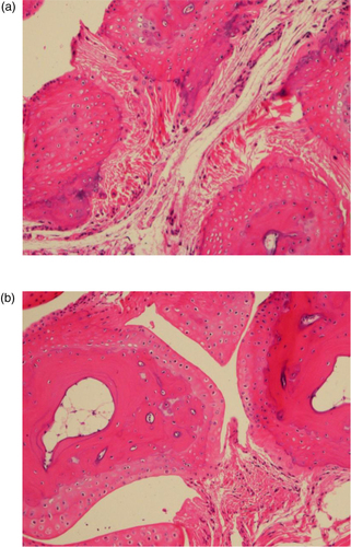 Fig. 3 Exostosis is a significant lesion seen with increasing age in carpal bones of mice. (a) Severe exostosis in a CB6F1 mouse in the oldest age cohort (28 months). (b) Absence of exostosis in a CB6F1 mouse in the youngest age cohort (4 months).