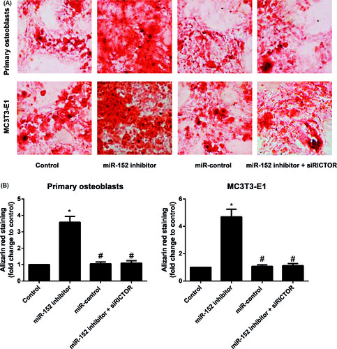 Figure 5. Mineralized nodules of primary osteoblasts and MC3T3-E1 cells in each group. Note: A, Mineralized nodules of primary osteoblasts and MC3T3-E1 cells in each group examined after Alizarin red staining; B, Quantitative analysis of alizarin red staining results in primary osteoblasts and MC3T3-E1 cells; *p< 0.05 compared with Control group; #p< 0.05 compared with miR-152 inhibitor group.