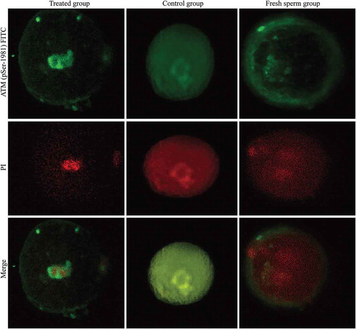 Figure 4. Formation of the pSer1981-ATM focuses in three groups. ATM (pSer-1981) was activated in both the treated group and the untreated group, but no ATM (pSer-1981) signal was detected in the control group. Fluorescence analysis indicated that the signal intensity was significantly stronger in the treated group than in the untreated group (0.0196 ± 0.0103 vs. 0.0083 ± 0.0066, P < 0.05).