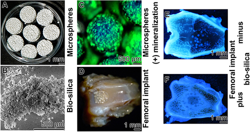 Figure 4 Morphogenetic activity of biosilica in animal experiments (rabbits) - regeneration of bone in holes drilled into patellar grooves. (A) Microspheres embedded in pellets and (B) biosilica prepared by silicatein for the implant experiments. (C) The microspheres were fabricated together with biosilica. Staining of the mineral nodules formed in rabbits after insertion for 5 days. Staining with OsteoImage (fluorescence flashing). In the (D) femoral implant experiments, new bone formation was detected after in vivo staining with (E and F) oxytetracycline dihydrate under UV light. A striking difference was found between β-TCP controls (E) and biosilica-supplemented microspheres (F). Adapted from Bone, volume 67, Wang SF, Wang XH, Draenert FG, et al. Bioactive and biodegradable silica biomaterial for bone regeneration. 292–304. © 2014, with permissions from Elsevier Inc.Citation83