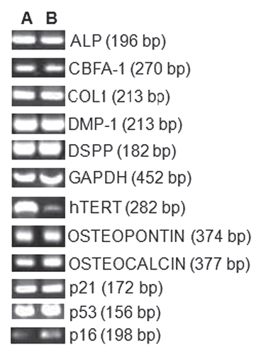 Figure 4 RT-PCR results for odontoblastic differentiation genes (ALP, cbfa-1, Col-1, DMP-1, DSPP, Osteopontin and Osteocalcin) and growth regulating factors p16, p21 and p53. Lane A, tDPSCs and Lane B, nDPSCs. GAPDH was run as an internal control and water as the negative control for both groups.