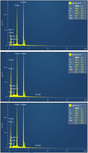 Figure 2. (a) Energy Dispersive Spectrometer (EDS) analysis of bone char. (b) Energy Dispersive Spectrometer (EDS) analysis of dung char.