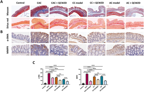 Figure 8 QCWZD attenuates inflammation-induced intestinal fibrosis. (A) Intestinal fibrosis detected by Masson trichrome and Sirius red staining; (B) α-SMA and MMP9 expression in immunohistochemistry; (C) Semi-quantitative immunohistochemical analysis of α-SMA and MMP9. **P < 0.01, ***P < 0.001.