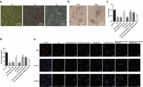 Figure 6. Inhibited miR-183 and overexpressed Foxp1 promote neuron proliferation in EP rats. (a), observation of neuron morphology of rats’ hippocampus (200 ×); (b), expression of NF of neurons in rats’ hippocampus; (c), comparison of cell proliferation ability among the groups; (d), positive cells in EdU staining of each group; (e), representative images of EdU staining (400 ×), * P < 0.05 vs the control group, + P < 0.05 vs the EP + inhibitor NC group, # P < 0.05 vs the EP + oe-NC group, & P < 0.05 vs the EP + miR-183 inhibitor + siRNA-NC group. The experiment was independently repeated for 3 times, the measurement data conforming to the normal distribution were performed as mean ± standard deviation, one-way ANOVA was employed for comparisons among multiple groups, and Tukey’s post hoc test was used for pairwise comparisons after one-way ANOVA
