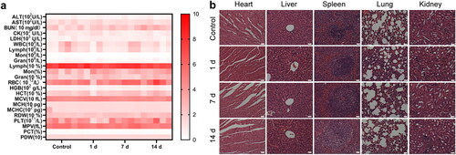 Figure 10. Biosafety of IRP NPs. (a) Biochemical assay and hematology analysis of mice intravenously injected with IRP NPs. The blood samples were collected at pre-determined time points (0, 1, 7, and 14 d) post-injection. (b) H&E staining of tissue sections from major organs after treatments (scale bar: 50 µm).