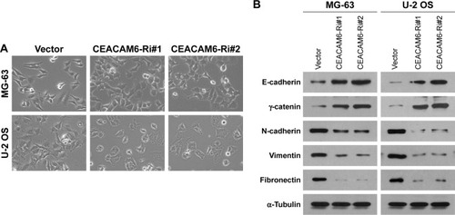 Figure 4 CEACAM6 facilitates EMT in osteosarcoma cell lines.
