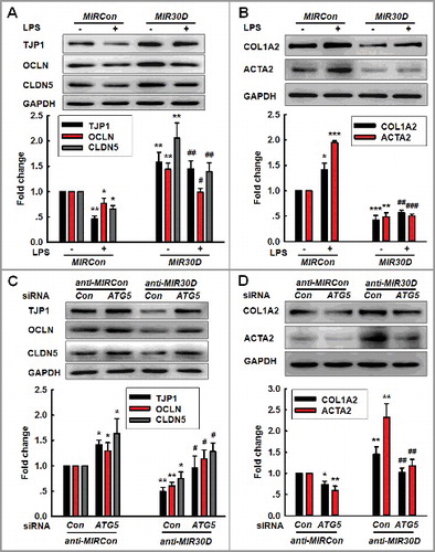 Figure 4. The MIR30D-ATG5 axis plays an important role in the EndoMT. (A and B) Transduction of HBMECs with MIR30D lentivirus significantly inhibited the LPS-induced decreases in the TJP expression levels (A) and increases in the mesenchymal cell marker expression (B). HBMECs were transduced with the MIR30D lentivirus for 24 h and were subsequently incubated with LPS (10 ng/ml) for 24 h. All data are presented as the mean ± SD of 3 independent experiments. *P<0.05, **P<0.01, ***P<0.001 vs. the MIRCon group. #P<0.05, ##P<0.01, ###P<0.001 vs. the LPS-treated MIRCon group via one-way ANOVA followed by the Holm-Sidak test. (C and D) Transduction of HBMECs with the ATG5 siRNA significantly inhibited the decreases in the TJP expression levels (C) and the increases in the mesenchymal cell marker expression (D) induced by anti-MIR30D. HBMECs were cotransduced with anti-MIRCon or anti-MIR30D and either control siRNA or ATG5 siRNA for 24 h. All data are presented as the mean ± SD of 3 independent experiments. *P<0.05, **P<0.01 vs. the anti-MIRCon group with the control siRNA. #P<0.05, ##P<0.01 vs. the anti-MIR30D cotransduced with the control siRNA via one-way ANOVA followed by the Holm-Sidak test.