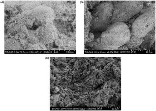 Figure 4. Scanning electron microscopy of liver tissue. Liver specimens were collected immediately after microwave ablation at 25 W for 60 s. (A) Normal liver tissue in an untreated area. (B) Hepatocytes in the transition zone. (C) Liver tissue in the central zone underwent coagulative necrosis, and no intact cells were observed.