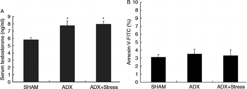 Figure 3.  Serum testosterone concentration and the apoptotic frequency of Leydig cells in ADX rats subjected to CUS treatment. ADX+stress group: ADX and exposed to CUS for 21 days; SHAM group: sham surgery as a control. (A) Both the ADX group and ADX+stress group had elevated serum testosterone concentrations compared with the SHAM group. *P < 0.05, vs. SHAM, one-way ANOVA. Serum testosterone concentration was not significantly different between the ADX group and ADX+stress group (P>0.05). Values are mean ± SD (n = 24 in each group). (B) The apoptotic frequency of Leydig cells in these three groups was not significantly different from each other (P>0.05, one-way ANOVA). Values are shown as mean ± SD (n = 3 per group).