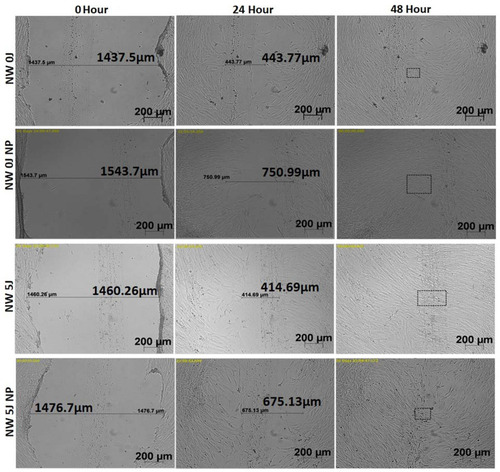 Figure 2 Time-lapse micrographs of non-irradiated normal wounded cells (NW 0J); non-irradiated, G-AgNP treated normal wounded cells (NW 0J NP); irradiated, normal wounded cells (NW 5J); and irradiated, G-AgNP treated normal wounded cells (NW 5J NP), analysed at 0, 24 and 48 h.
