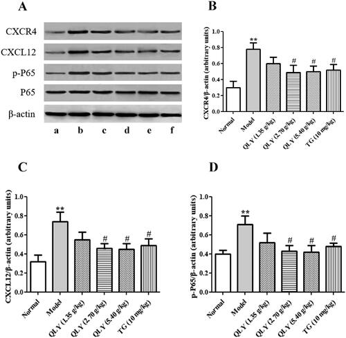 Figure 8. Effects of QLY granules on expression of CXCL12-mediated inflammatory signalling in AA rats. (A) Representative images of Western blotting of the expression of CXCL12, CXCR4, P65 and p-P65. a: normal; b: model; c: QLY granules (1.35 g/kg); d: QLY granules (2.70 g/kg); e: QLY granules (5.40 g/kg); f: TG (10 mg/kg). Western blotting semi-quantification of (B) CXCR4 and (C) CXCL12. (D) Ratio of p-P65 / total P65. Data are expressed as the mean ± SD, with 3 samples in each group. **p < 0.01 vs. normal, #p < 0.05, vs. model.