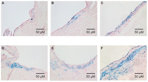 Figure 4 Prussian blue staining of histopathological sections.Notes: (A) dose 1, (B) dose 2, (C) dose 3 of D-USPIO; (D) dose 1, (E) dose 2, (F) dose 3 of DM-USPIO. There was a marked iron uptake in the arterial walls of all rabbits injected with either D- or DM-USPIO. The Prussian blue-stained area increased in both the D- and DM-USPIO group in a dose-dependent manner.Abbreviations: D-USPIO, dextran-coated ultrasmall superparamagnetic iron oxide; DM-USPIO, mannan–dextran-coated ultrasmall superparamagnetic iron oxide.