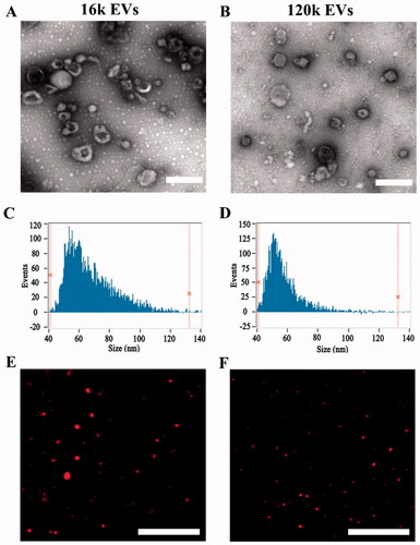 Figure 1. Characterization of EVs and drug-loaded EVs. TEM image of 16k EVs (A) and 120k EVs (B). Scale bar: 200 nm. Size distribution of 16k EVs (C) and 120k EVs (D) measured by nano-flow cytometer. Fluorescence image of 16k EVs (E) and 120k EVs (F). Scale bar: 20 µm.