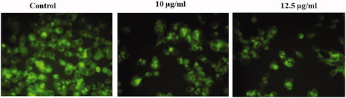 Figure 6. Represents that the mitochondrial membrane permeability was determined in untreated and treated HepG2 cells with AuNPs. The mitochondrial membrane permeability was stable (strong fluorescence) in untreated HepG2 cells. The mitochondrial membrane permeability was damaged (weak fluorescence) in HepG2 cells treated with 10 µg/ml AuNPs. 10 µg/ml AuNPs represents that the mitochondrial membrane permeability was damaged more (weaker fluorescence) in HepG2 cells.