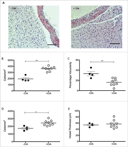 Figure 2. Morphological characterization of thoracic PVAT in DBA/1 naïve and CIA mice (A) Representative images of –CIA and CIA thoracic aorta + PVAT show differences in morphology between the non-arthritic and arthritic mice. Scale bar = 100μm. (B) Total cell number and (C) vacuolarity was analyzed in thoracic PVAT. In the thoracic aorta, (D) total cell number and (E) vessel thickness were measured. –CIA (n = 4), +CIA (n = 8). Data expressed as mean ± SEM. *** = p < 0.001, ** = p < 0.01.