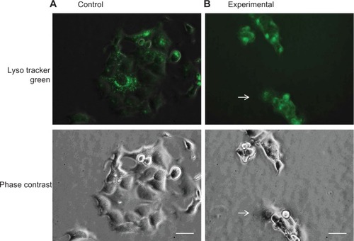 Figure 7 Morphological comparison of lysosomes.