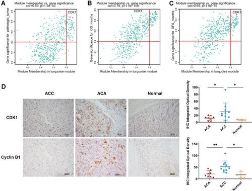 Figure 4 CCNB1 and CDK1 are the key genes in the turquoise module. (A–C) Significance of the genes in the turquoise module for three clinical characteristics. The significant genes were identified based on module membership > 0.8 and gene significance > 0.2. (D) Representative images of IHC staining of CDK1 and Cyclin B1 in different types of tissue specimens; the scale represents 100 μm (left panel). Quantification of protein levels according to IHC integrated optical density in ACC, ACA and normal tissues; *p < 0.05 and **p < 0.01 (right panel).