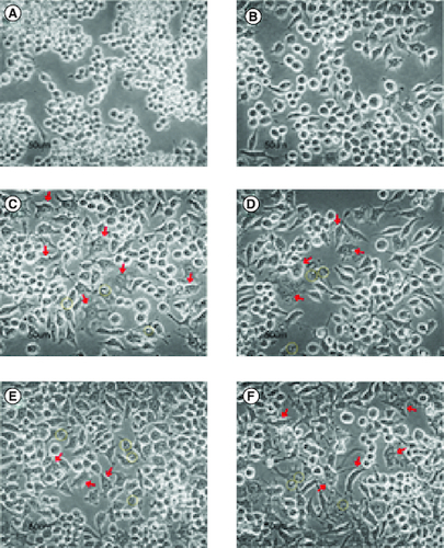 Figure 9. Cells morphology (400×).From negative control (A), LPS + DEX (B), LPS + GDEN 0 μg/ml (C), LPS + GDEN 10 μg/ml (D), LPS + GDEN 20 μg/ml (E), and LPS + GDEN 40 μg/ml (F). Red arrow represented irregular-shaped cells with pseudopodia; yellow circle represented vacuolization in cell.