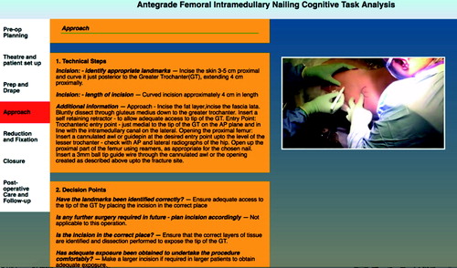 Figure 1. Snapshot of the IFINCTA tool showing the written information of the CTA on the left and the multimedia video clips and audio recordings on the right for the “approach” phase of the procedure.