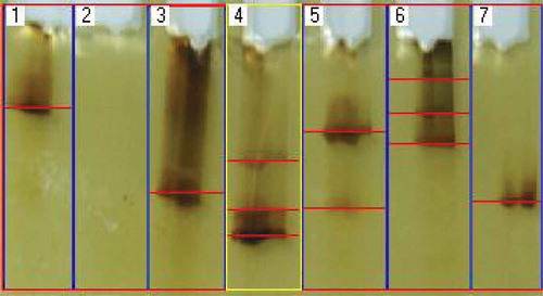 Figure 6. Amplified fungal DNA from culture-dependent endophytic fungi (Lane 1, 3 and 7), culture-independent endophytic fungi (Lane 4, 5 and 6) and seagrass (Lane 2) separated by DGGE.
