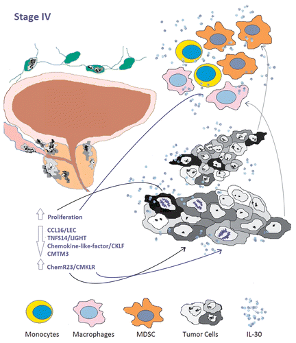Figure 1. Role of interleukin-30 in the prostate cancer microenvironment. Interleukin-30 (IL-30) may be produced by cancer cells as well as by tumor-reactive cells of myeloid origin, such as monocytes, macrophages and myeloid-derived suppressor cells (MDSCs). These immune cells constitute the major source of IL-30 within the lymph nodes that drain metastatic prostate cancer lesions. IL-30 may act not only on cancer cells of both primary and metastatic tumor lesions, but also on local immune cells and other cell types endowed with appropriate receptors, hence displaying functions that are for the most part hitherto unknown.